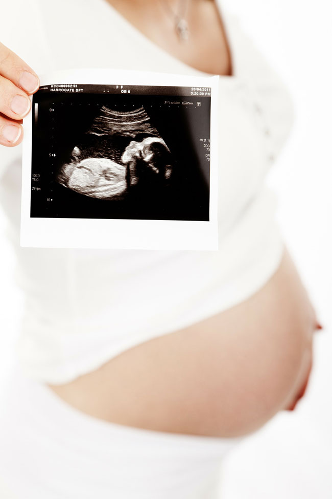 pregnant with sonography image infertility-fertility-baby-making-stories3